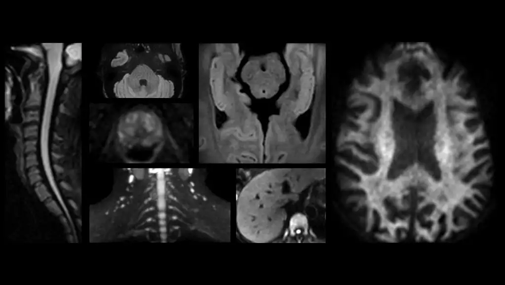 Higher diffusion IQ, for all anatomies